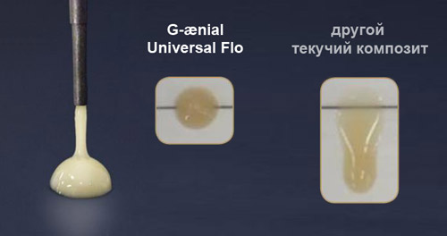   G-aenial Universal FLO