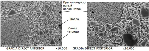 Gradia Direct, Градиа Директ NT, шприц (4ГР),Cветоотверждаемый микрофильный гибридный композит.GC