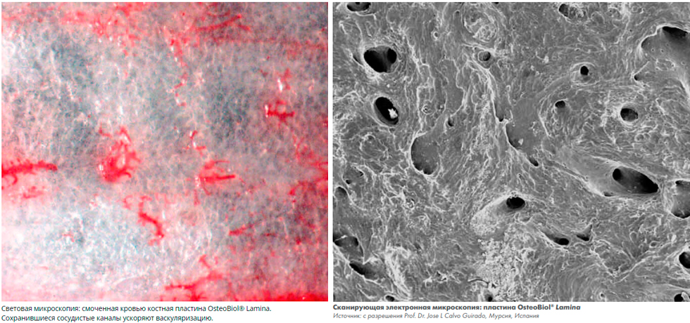 Костный материал Osteobiol Soft Cortical Lamina