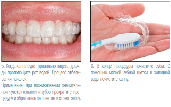 Отбеливание зубов Opalescence Томск Ягодная стоматология детская томск мюнниха 17